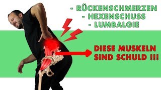 Rückenschmerzen durch blockierte Hüfte Baustellenanalyse amp Lösung [upl. by Royal]