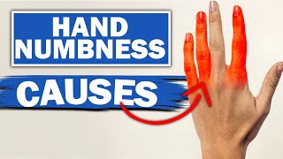 Expert Reveals MindBlowing Facts About Numbness amp Tingling In Fingers [upl. by Zoldi]