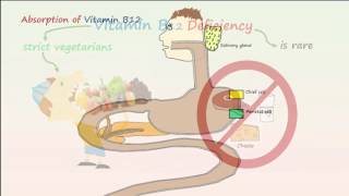 Megaloblastic Anemia Part 1 Vitamin B12 Deficiency Anemia [upl. by Asirrac]