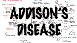 Addisons Disease  Overview clinical features pathophysiology investigations treatment [upl. by Asoj985]